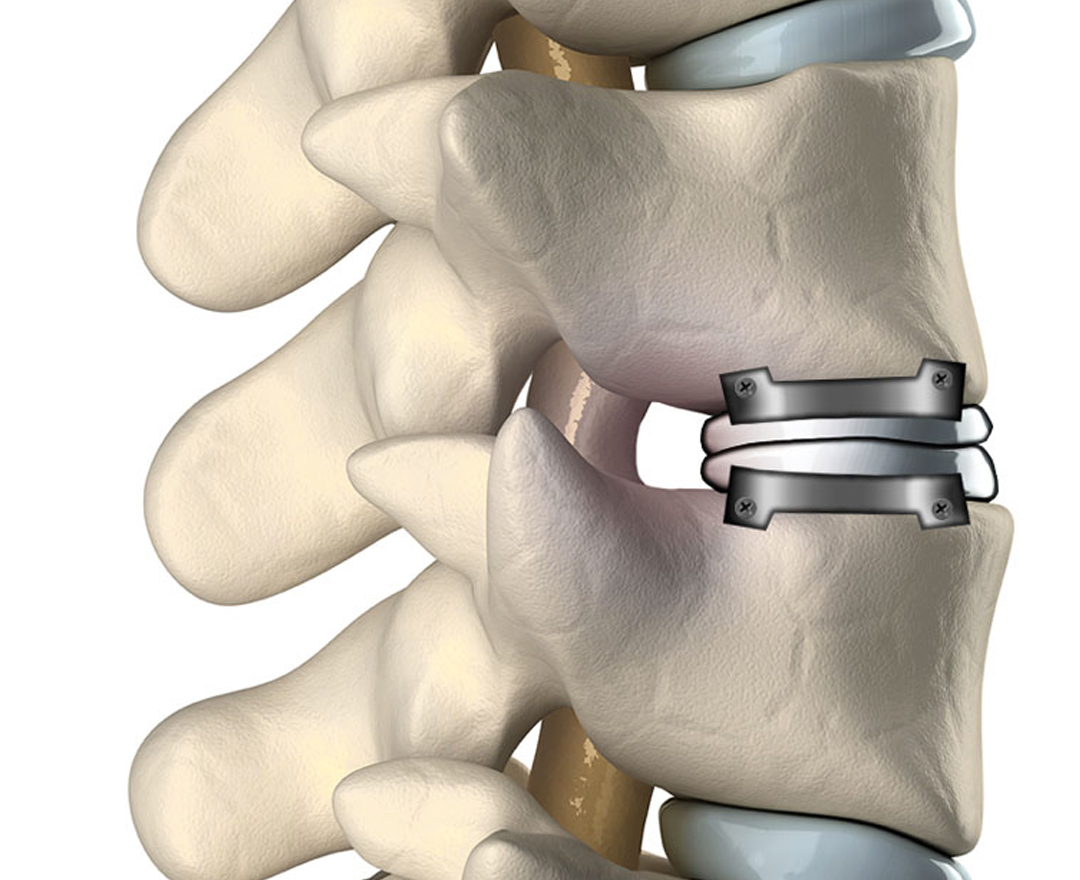 Healthcare consultation