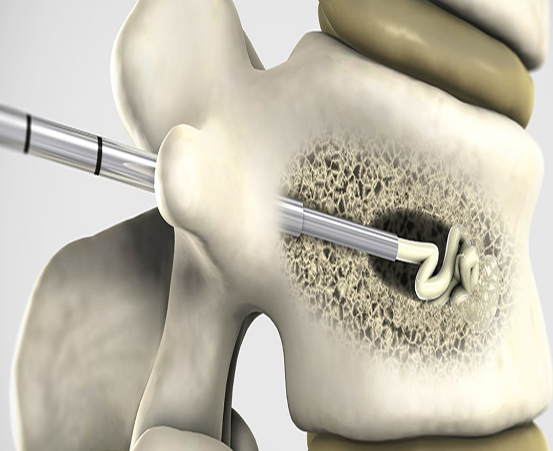 Healthcare consultation