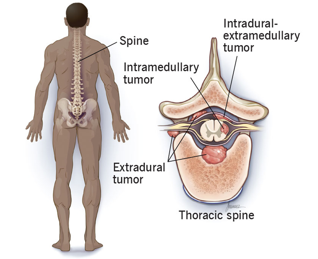 Healthcare consultation