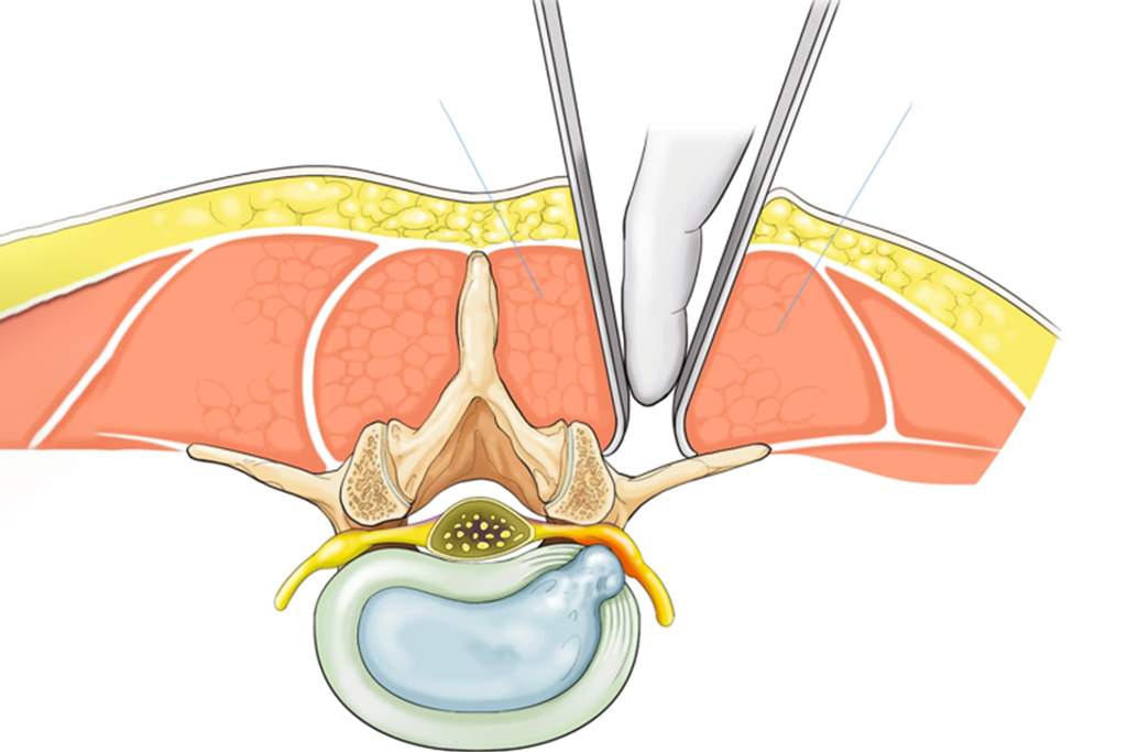 Emergency Department